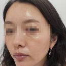 스킨부스터 종류 ECM 리투오 효과 내돈내산 리디엔에이 솔직 후기 | 비싼 스킨부스터 가격, 홈케어로 해결