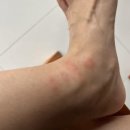 미키사세탁빨래방 | 발리 여행, 누사페니다에서 드디어(?) 베드버그 물린 후기 &amp; 서부 투어(오토바이) 후기