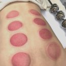 1269 | 구미 체형관리 피부관리 카리테스뷰티 에스테틱 솔직후기