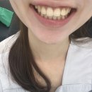 강남 | 강남 라미네이트 상담 후기 연예인 치과 추천 이유