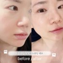 [전주] 만성동 에스테틱페브, 예민피부도 추천하는 세멘시트/슈퍼젝션블루 후기