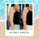 바디유니버스 | 웨딩핏 바디슈링크 팔뚝 300샷 + 바디씬주사 내돈내산 후기｜본식 2달 앞둔 예비신부 관리 (7일차)