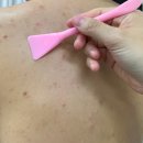 통계청 맞은 편 횡단보도 | 공덕 피부관리 피부보기(skin biew) 등드름 관리 후기
