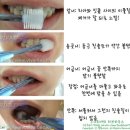 시그마덴탈 이미지