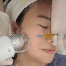 치유본의원 | 6개월마다 줄기세포 정맥주사 + 피부주사 직접 받는 김수연 원장의 시술 전 과정 및 후기