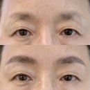 자연-이미지 | 부산자연눈썹문신, 이미지 변신 원한다면 꼭 바꿔야 할 포인트