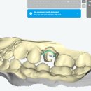 메이트치과기공소 이미지