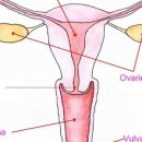 어썸테라피 이미지