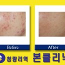 본피부과 이미지