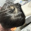 청소년샴푸 추천, 초등 정수리 냄새 잡는 방법