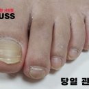 레푸스 사상점 이미지