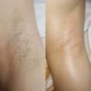 아리따운피부 이미지