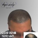 돕스칼프