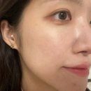 바이슈의원 | 바이슈의원 스킨보톡스 효과_내돈내산 일주일 후기!