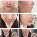 올가드림뷰티판교운중점 | 출산 후 피부 회복, 운중동 피부관리 올가드림뷰티 판교운중점 관리 후기