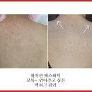 러브바디톡스