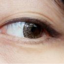 브라운메디컬 이미지