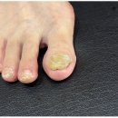 라이프업 | 목포 진도 발톱무좀 깔끔한 관리 후기 뷰티업라이프 가온네일&amp;페디