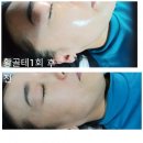 휴발관리