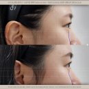 도곡유스앤영의원 이미지