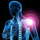 신앤박한의원 | [달서구/한의원] 석회성 건염 : 갑자기 어깨가 안올라가요