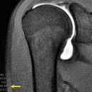 건협 강남센터, MRI자기공명 견관절조영검사 8월 27일부 시행 이미지