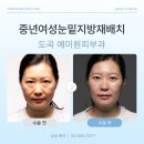 10년젊어지기 | 중년여성눈밑지 나이 들어 보이는 눈밑지방 10년 젊어지는 비결