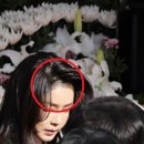 김헤어라인 이미지