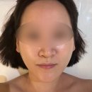 약수 | 약수에스테틱 릿에스테틱 수분진정케어 후기