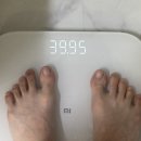 365엠씨(mc)병원 | 뼈뼈말라 인간 허파고리 엉덩이 필러 도전/ 뼈말라도 허파고리 지방이식이 될까? / 365 OO 병원 후기