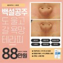 오리역 | 오리역 에스테틱 후기 지우다에스테틱