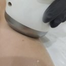 안양범계신부관리 마인힐에스테틱 승모근팔뚝라인 웨딩후기