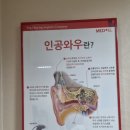 벨톤보청기 성남분당지사 | 성남보청기 정확히 들리니 삶이 달라졌어요