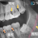 서울바정치과의원 이미지