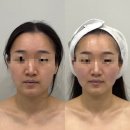 보니토에스테틱 - 동래구 아시아드대로164번가길 18-1 | 상무지구 피부관리 보니토에스테틱 웨딩관리 찐추천후기