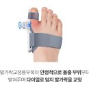 바른발가락 | 무지외반증 교정기 엄지 발가락 휨 1등급 의료기기 추천 후기