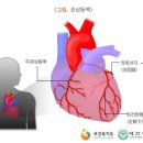 CK-MB의 절대수치[정상범위:0-5ng/ml] 이미지