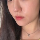 삼성더봄피부과의원 | 압구정피부과 < 비욘드 의원 > 온다리프팅 1회차 일주일 경과 솔직 후기