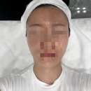 티에스(TS)메디칼 이미지