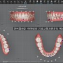 가나가와치과의원 네이버블로그