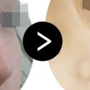 한형일성형외과의원 이미지