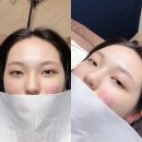 데이안브로우
