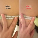 신진메디칼 | 안양 에스테틱 웨딩관리로 유명한 메종드마인 안양범계점 추천 후기(팔뚝 전후 사진 O)