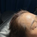 행복한헤어라인