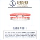 리더스치과기공소 이미지