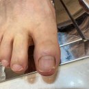 제이톡뷰티 | 안양 평촌 발톱무좀 대만족 관리 후기 제이톡뷰티 내성발톱 무좀 발각질 네일 문제성발