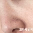 피네의원 이미지