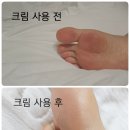 부기먼트