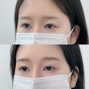 별 내린 커피 | 건대 눈썹 문신 잘하는 곳 별내린 뷰티 후기