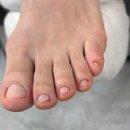 문제성 손, 발 오감네일 이미지